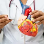 Biaya Pasang Ring Jantung (Stent) di Indonesia