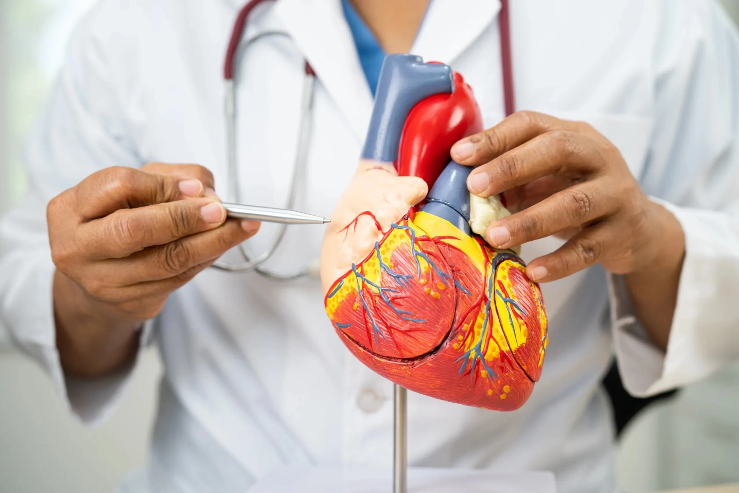 Biaya Pasang Ring Jantung (Stent) di Indonesia