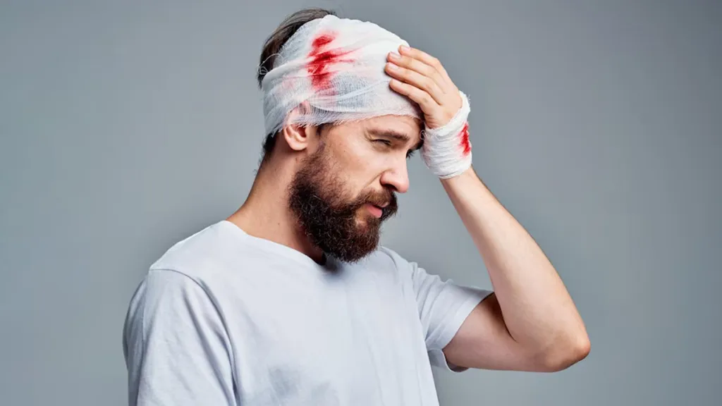 Brain Injury (TBI) from a Truck Crash, You Need a Top Attorney