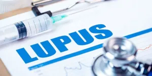 Perbedaan Lupus (SLE) dan Rheumatoid Arthritis