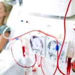 Terapi Pengganti Ginjal Selain Cuci Darah